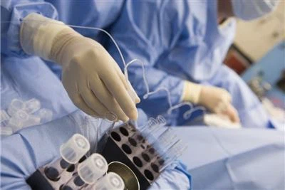 Kim lấy trứng: Những hiểu biết chính cho các kỹ thuật sinh sản được hỗ trợ