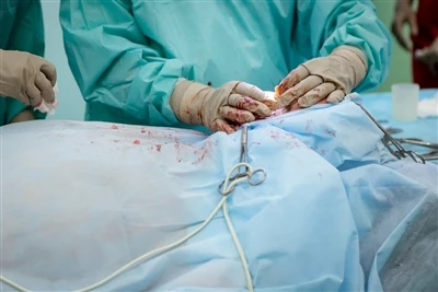 Biện pháp bảo vệ cuối cùng: Về logic đóng gói và giao hàng của các nhà sản xu...